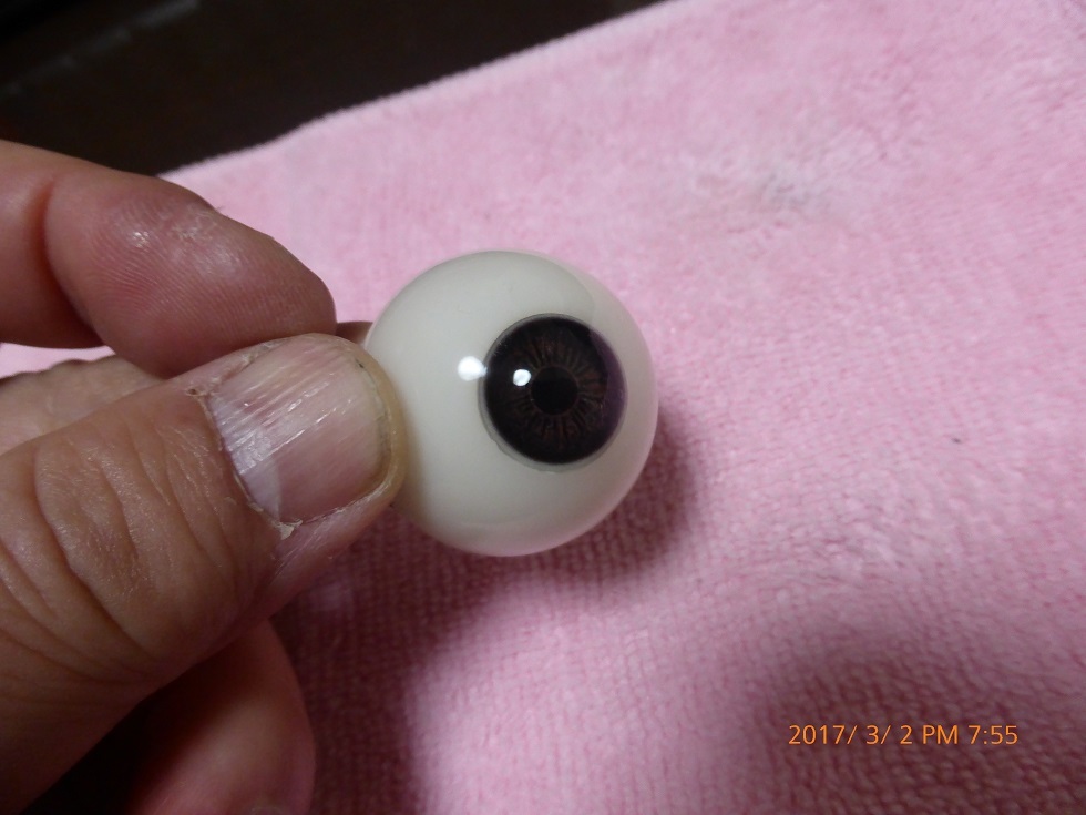 景子さんの眼の治療-1