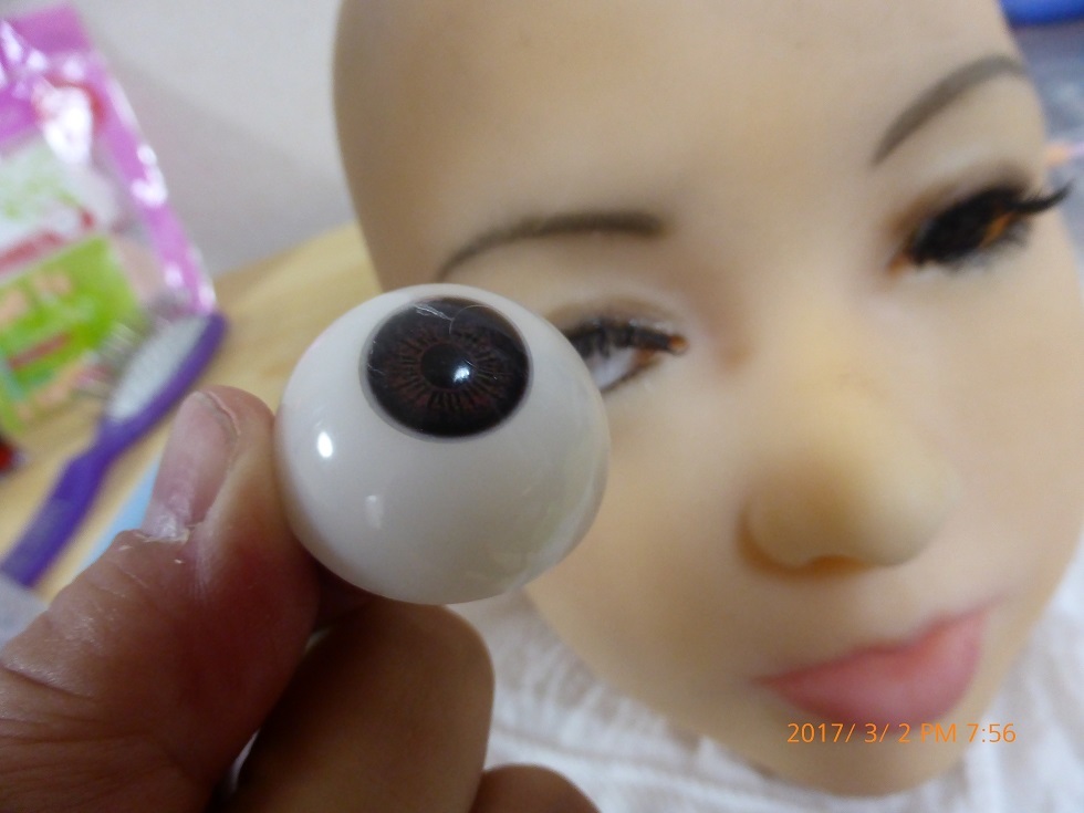 景子さんの眼の治療-3